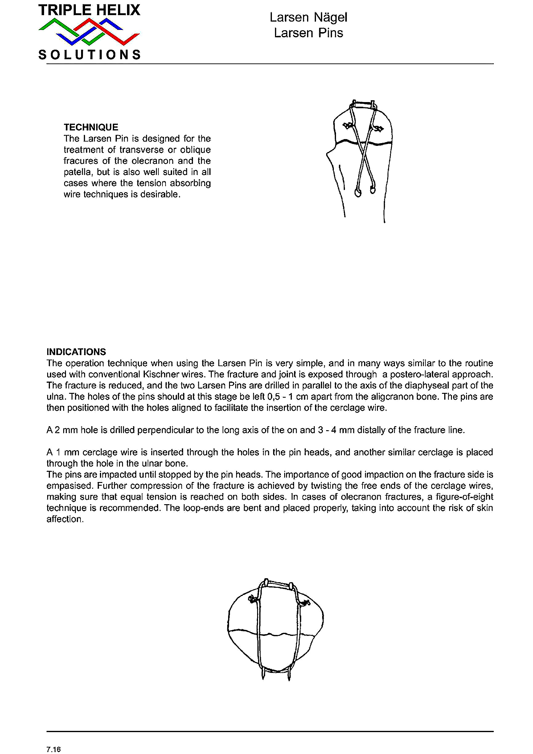 Larsen Pin Operative Technique - page 37